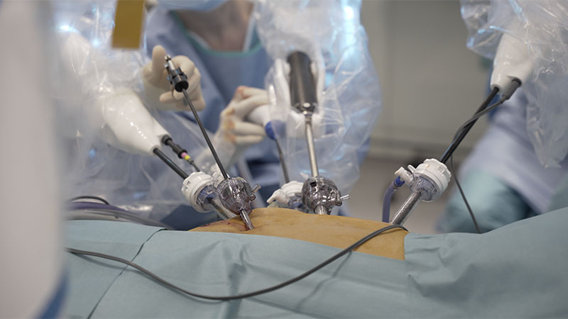manual and robotic surgery